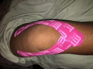 MCL-Knee-strain-VMO Sprain