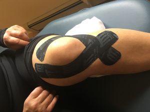 knee-pain-ACL-Sprain